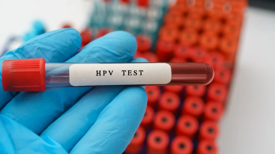 HPV Testing Market