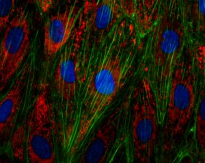 immunofluorescence assay